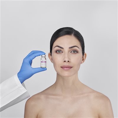 WiQ0 Peels
